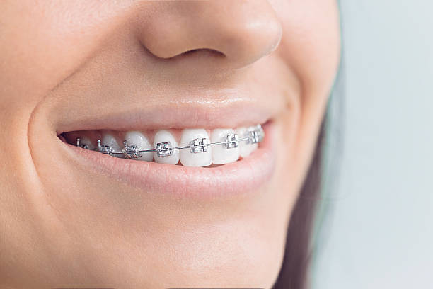 Best Dental Inlays and Onlays  in White Meadow Lake, NJ